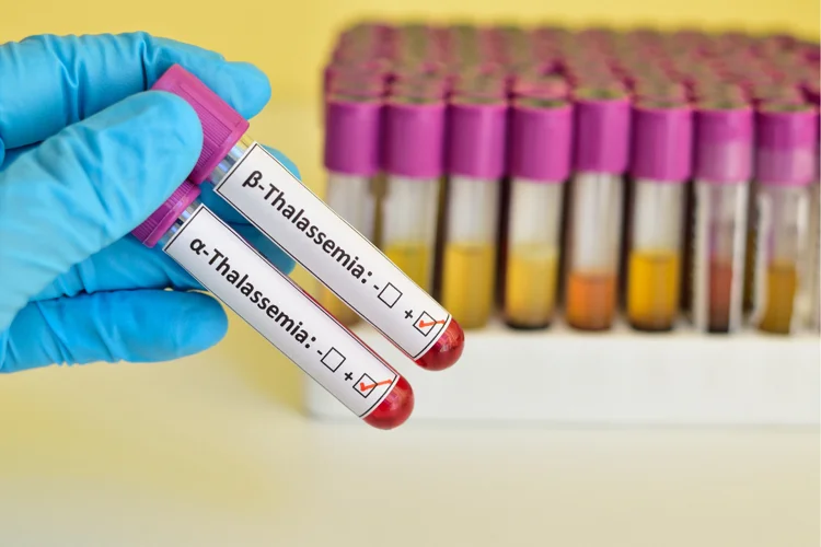 Alpha and Beta thalassaemia.