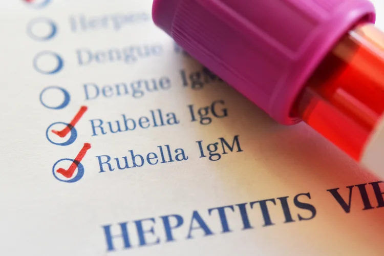 Blood sample on Rubella IgG and IgM test form showing laboratory check for Rubella immunity status.
