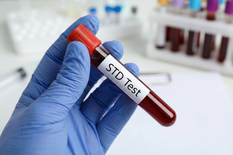 Gloved hand holding a blood sample tube labelled STD test in a clinic.