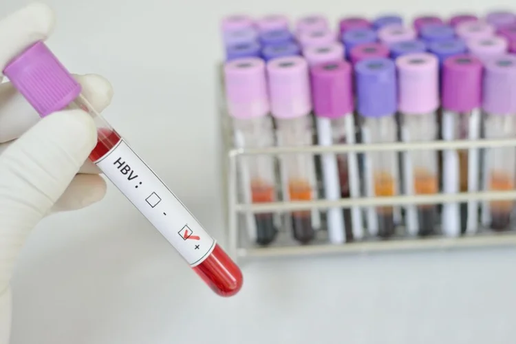 Blood test as part of regular STD testing.