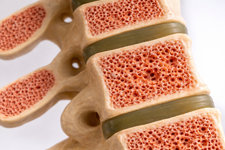 Illustration of bone structure showing density changes linked to menopause.