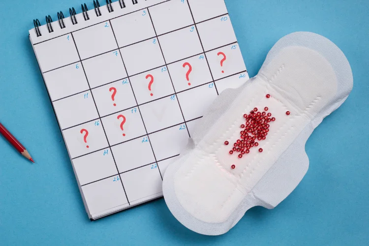 Calendar with missed periods and menstrual pad representing irregular or absent periods due to PCOS.