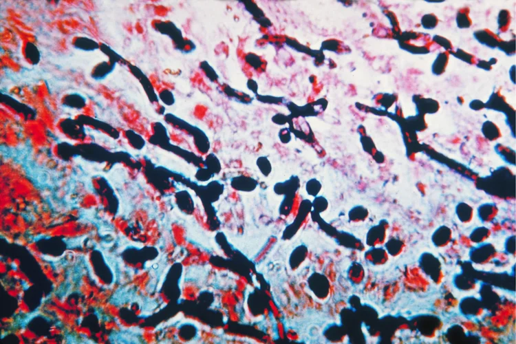 Microscopic view of Candida albicans, the fungus causing vaginal yeast infections.