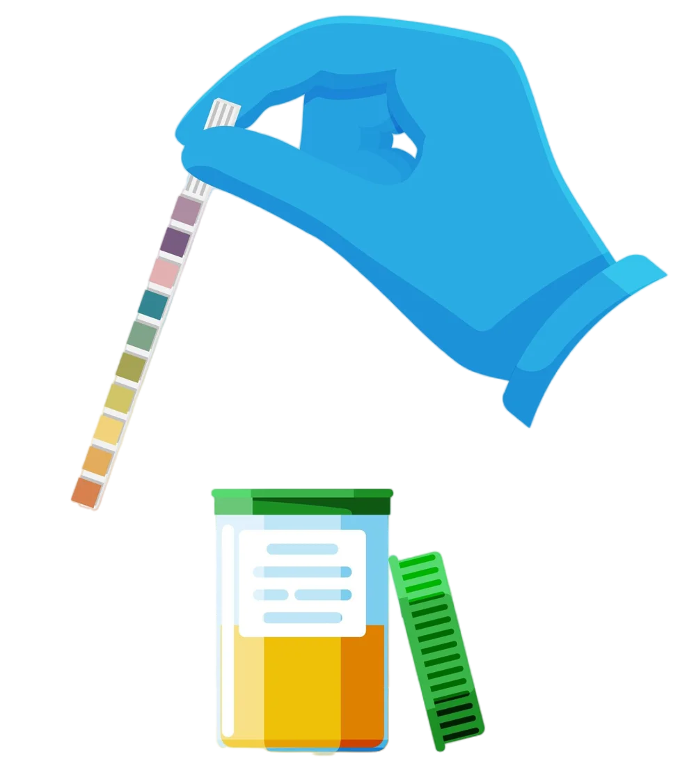 Chemical test of urine using dipstick.