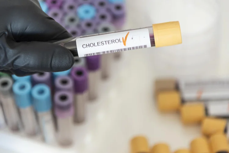 Test tube of patient's blood to be measured for cholesterol levels.