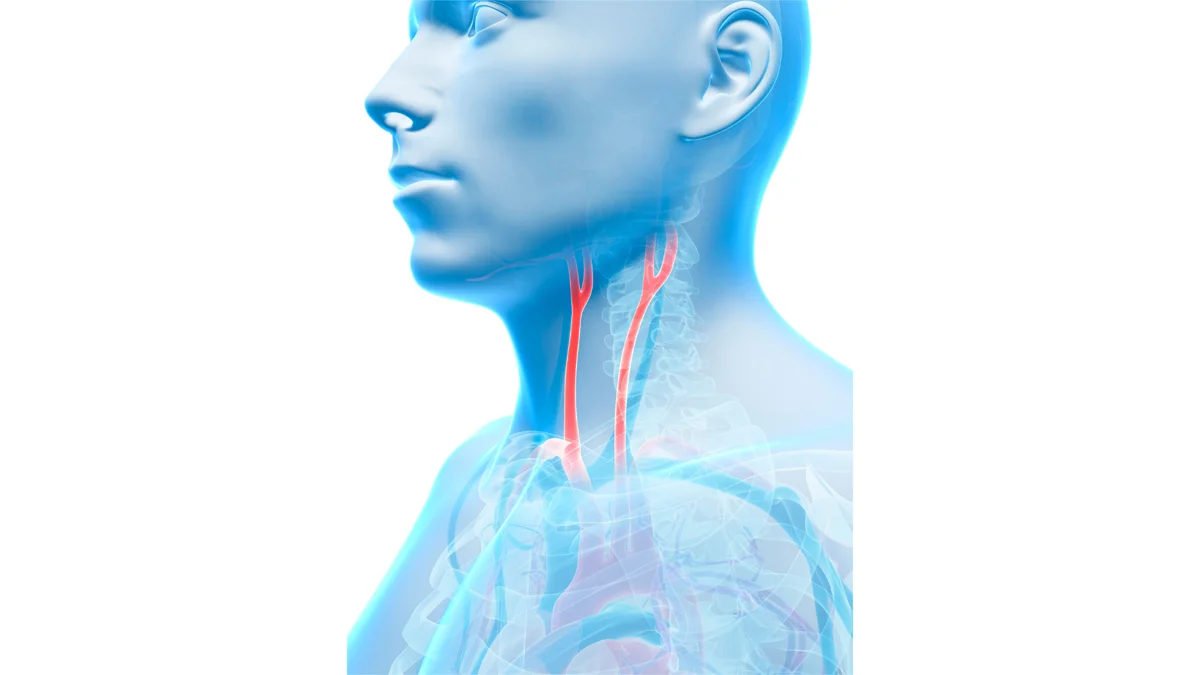 CIMT test for carotid arteries.