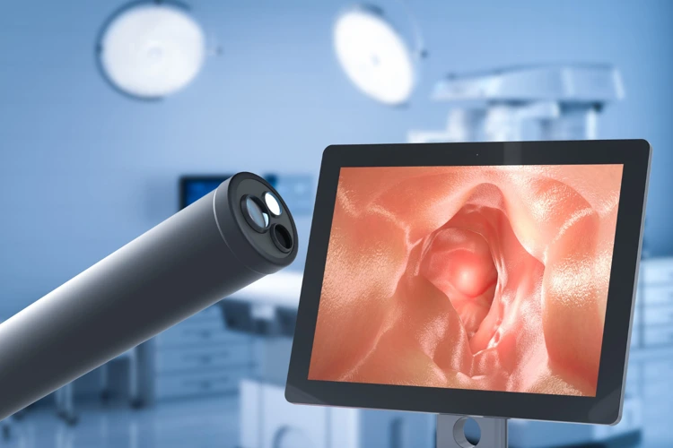3D image of endoscope with monitor displaying intestine for colonoscopy procedure.