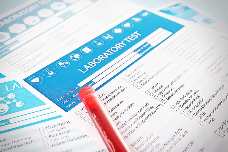 D-dimer test laboratory form and blood sample for diagnosing clotting disorders.