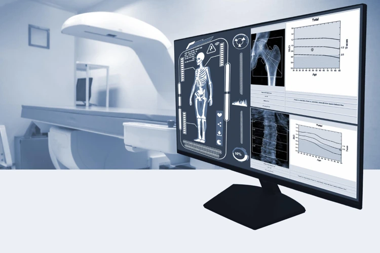 Dexa Scan For Bone: Get Test Cost, Purpose & Pictures [2021]