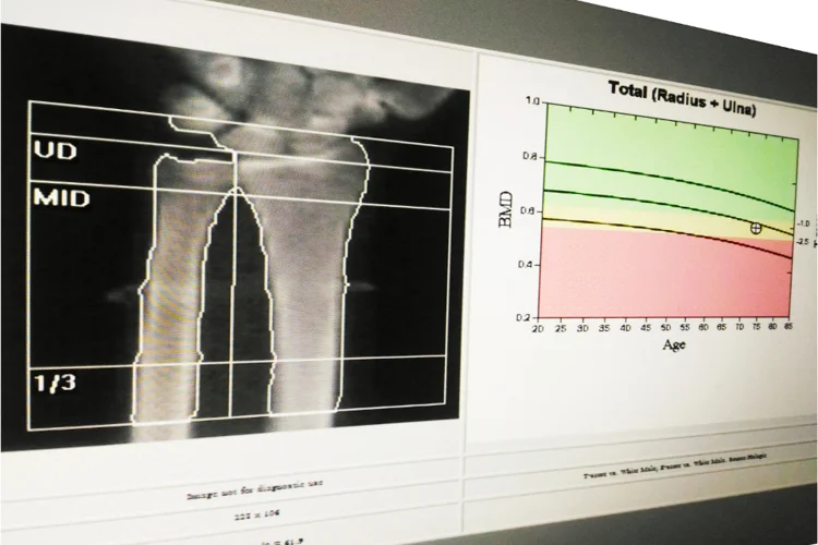 DEXA scan report.