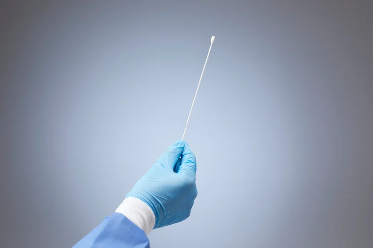Doctor wearing blue gloves holding urethral swab used for Ureaplasma diagnosis in Singapore.