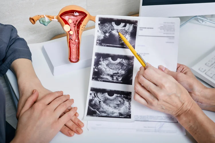 Doctor explaining ultrasound results to female patient highlighting PCOS symptoms and complications.
