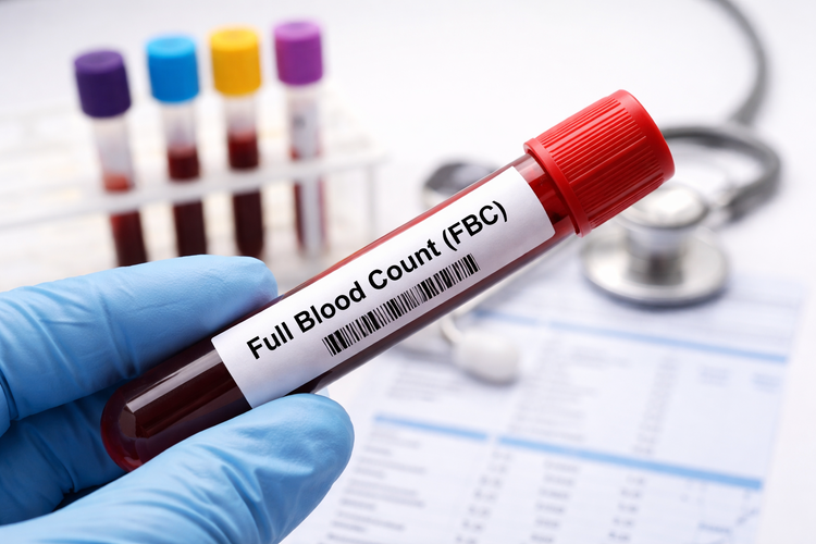 Blood sample tube labelled Full Blood Count (FBC) held by a gloved hand.
