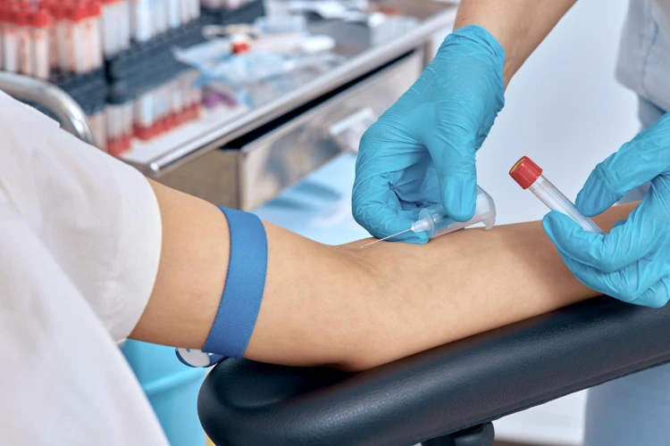 Nurse drawing blood from patient for Full Blood Count (FBC) test.