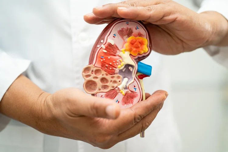 Doctor holding a cut-out model of a kidney to highlight kidney disease.