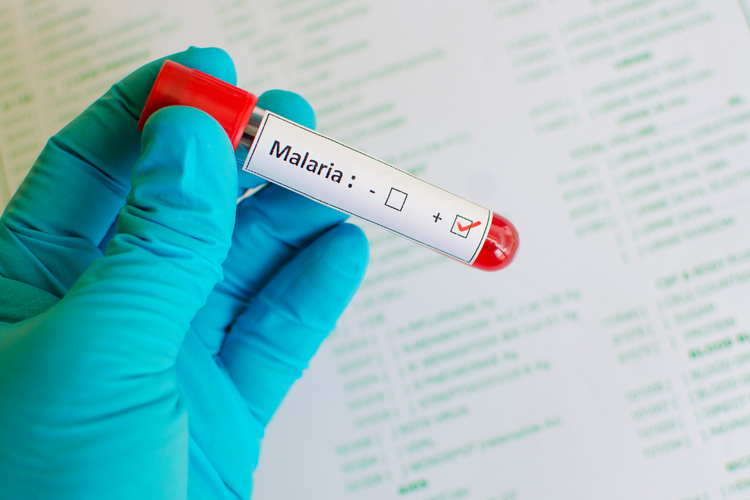 Blood sample labelled positive for malaria, illustrating diagnostic testing.