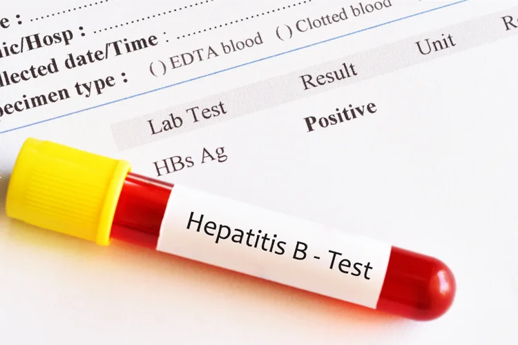 Positive STD test results.