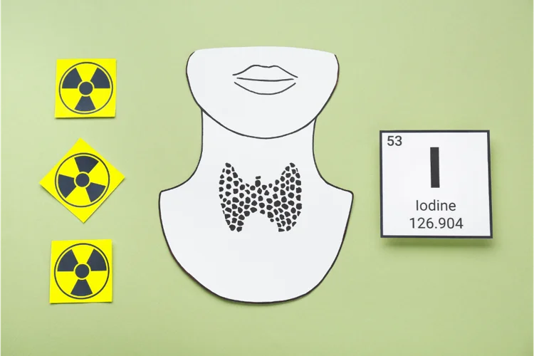 Radioactive iodine therapy to treat hyperthyroidism.