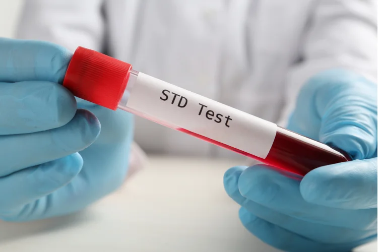 Regular STIs screening help to maintain sexual health.