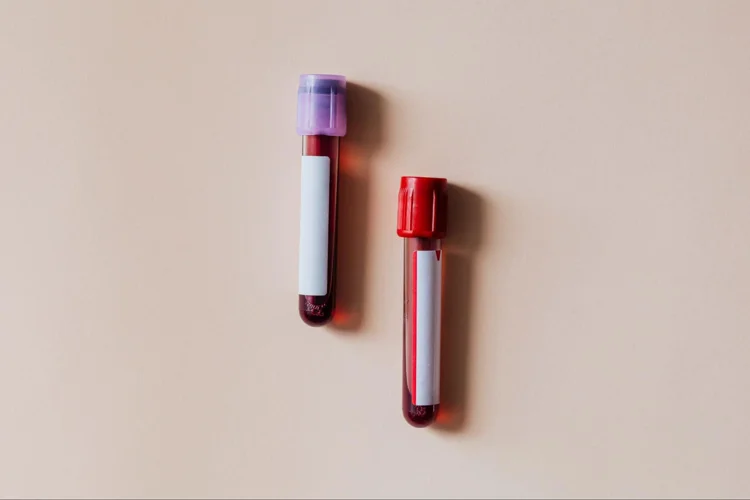 Test tubes containing blood samples for STD testing.