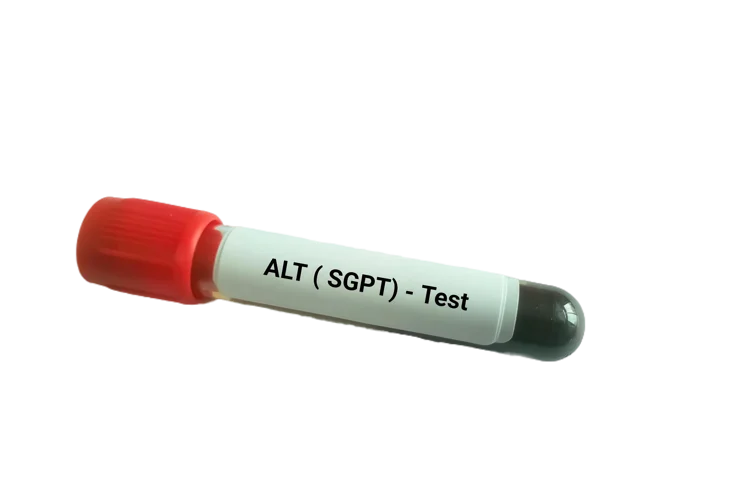 Testing blood for alanine transaminase to assess liver function.