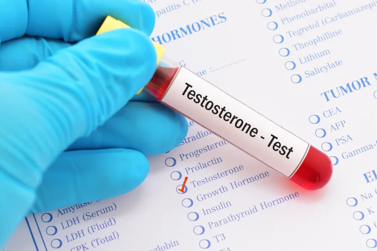 Testing testosterone levels for andropause.