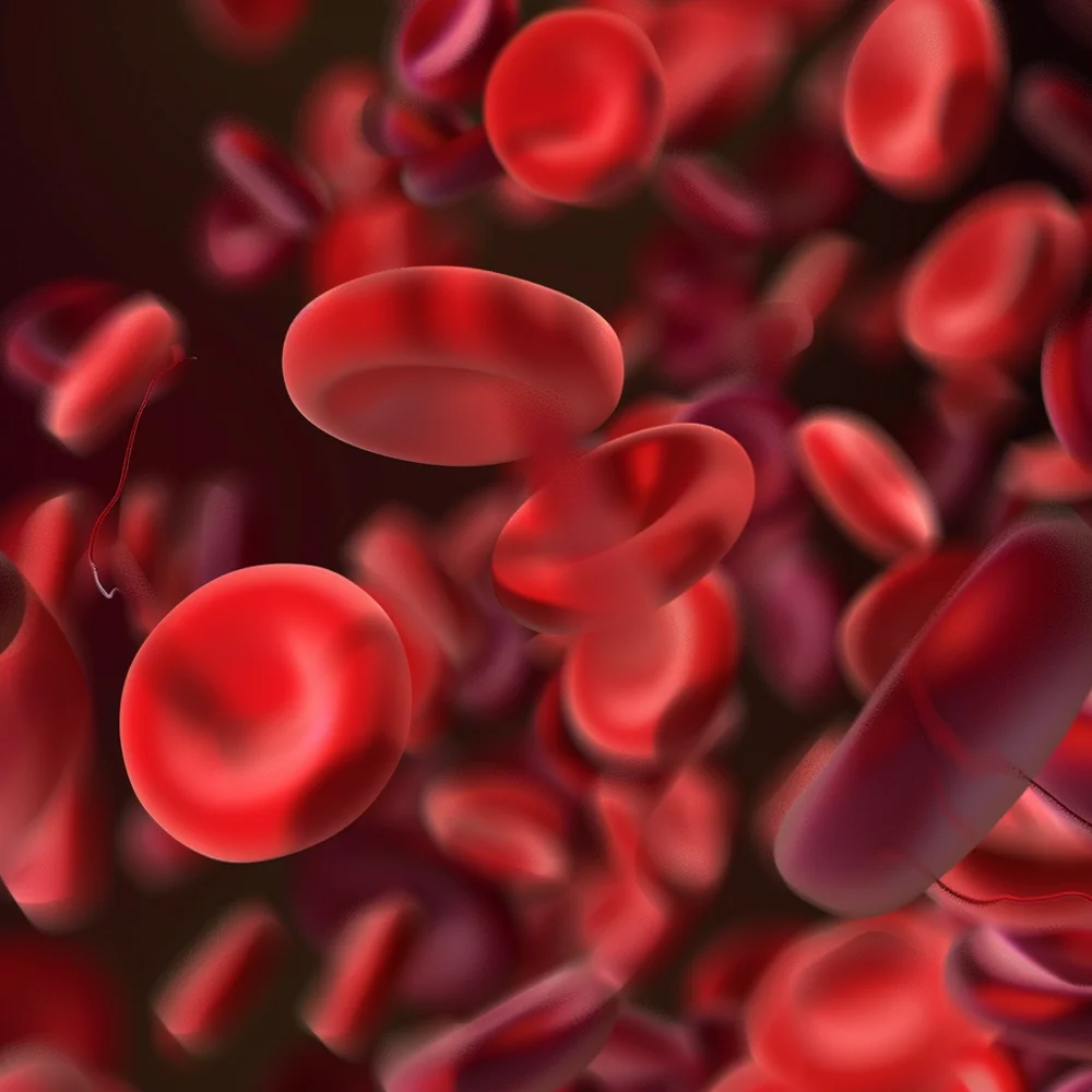 Thalassaemia affecting the body’s ability to produce haemoglobin.