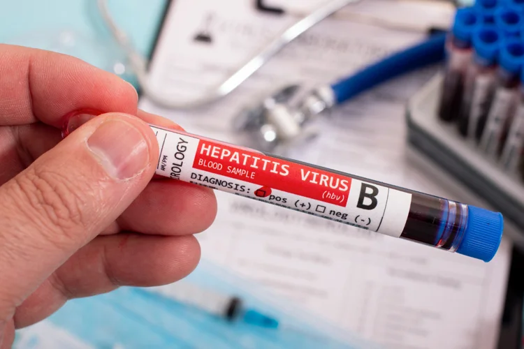 Vial containing patient's blood to be used for Hepatitis B Screening Test.