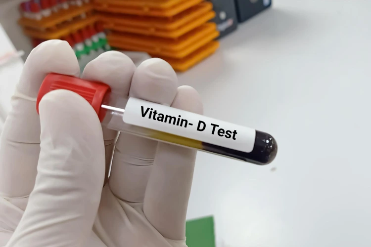 Test tube containing patient's blood to be tested for Vitamin D deficiency.