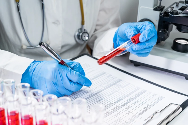 Doctor making notes from patient's blood sample for vitamin deficiency testing.